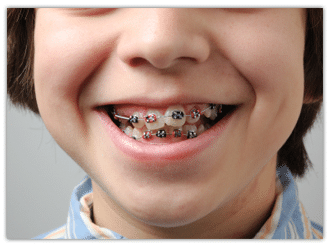 Orthodontica